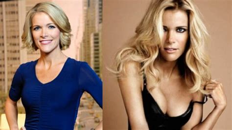 Megyn Kelly’s Plastic Surgery: What Happened to Her?