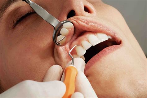 Common Types of Cosmetic Dentistry Procedures | District Dentistry