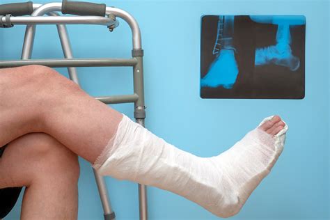 Foot And Ankle Surgery Las Vegas | Foot And Ankle Surgeons