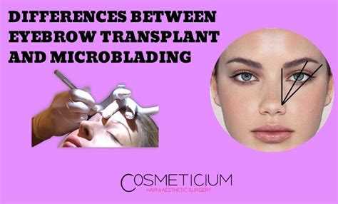 Differences Between Eyebrow Transplantation and Microblading