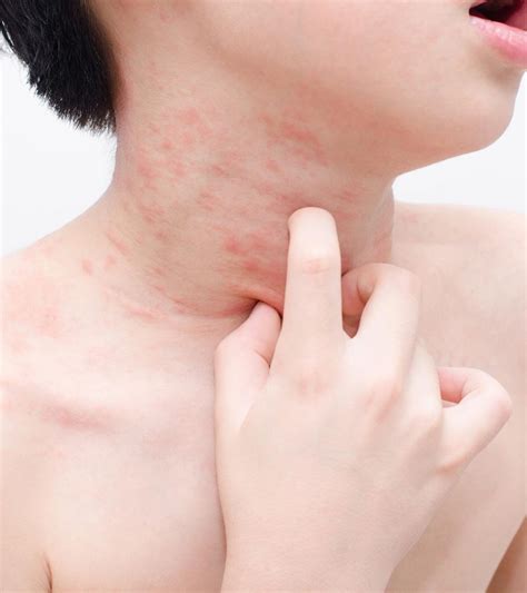 Skin Rashes In Children