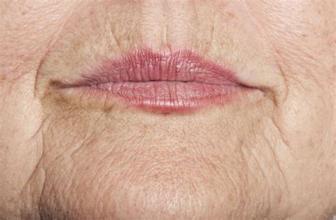 3 Facial Exercises for Upper Lip Lines and Wrinkles | How to line lips, Lip wrinkles, Wrinkly lips