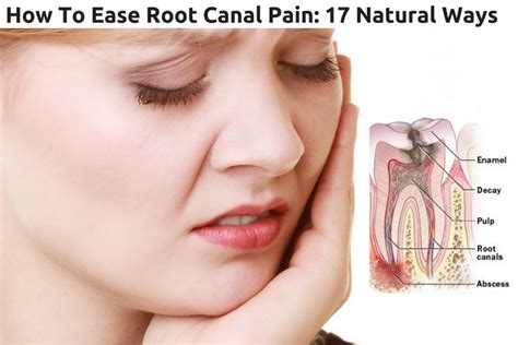 How To Ease Root Canal Pain: 17 Natural Ways – Wellness.guide