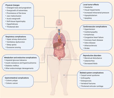 Classic clinical signs and symptoms of acromegaly | Download Scientific ...