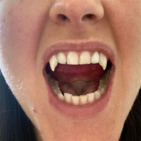 Vampire Teeth Fangs for Women or Teens That You Mold to | Etsy