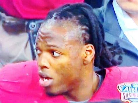 Alabama RB Derrick Henry Hairline (pics)