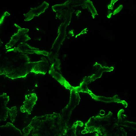 World’s oldest fungi, found in fossils, may rewrite Earth’s history ...