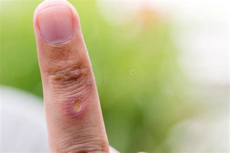 Bacterial Skin Infection Pyoderma or Lichen on the Skin of a Red Cat. Stock Photo - Image of ...