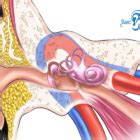 Pulsatile Tinnitus Causes & Treatments