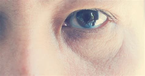 What does aging do to our eyes?