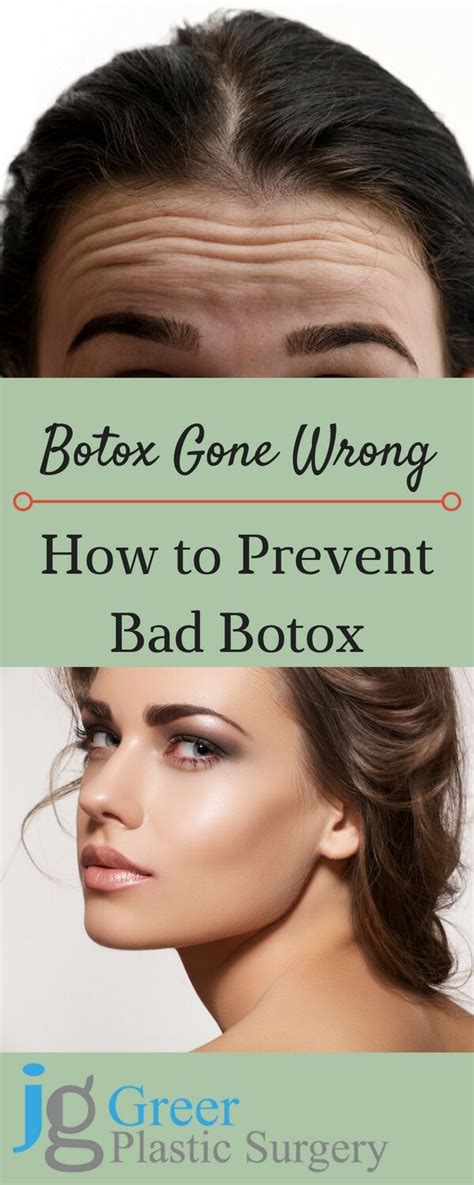 When botox gone wrong – Artofit