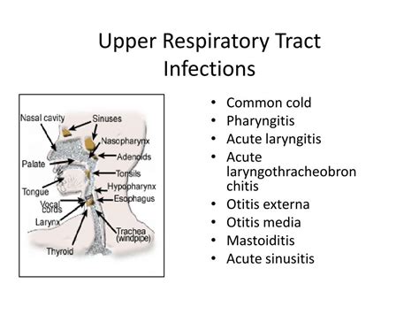 PPT - Upper Respiratory Tract Infections and Influenza PowerPoint Presentation - ID:6305206