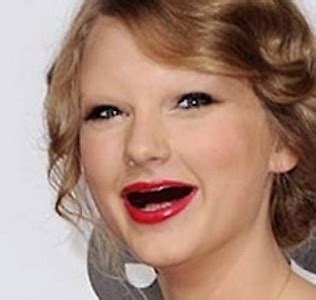 taylor swift teeth