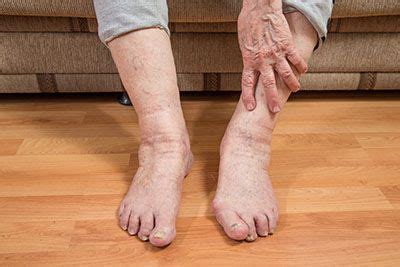 Great Exercises to Keep Senior Feet Strong | Neuropathy, Health disease, Diabetic neuropathy