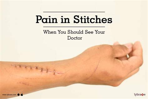 Pain in Stitches - When You Should See Your Doctor? - By Dr. Kanwaljit Chahl | Lybrate