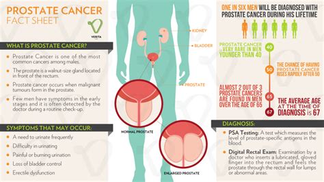 Can Green Tea Reduce The Risk Of Prostate Cancer? - Verita Life