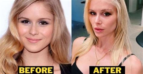 Erin Moriarty Plastic Surgery: Did The Boys Star Have Cosmetic ...