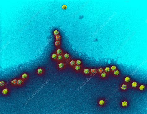 Vesicular exanthema of swine virus, TEM - Stock Image - M050/0833 - Science Photo Library