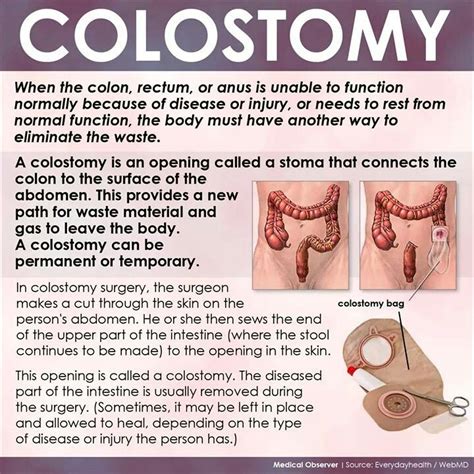 Colostomy Oral Health, Physical Health, Healthy Tips, Healthy Body, Stoma, Nursing Tips, Anus ...