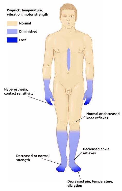 Symptoms of chemotherapy-induced peripheral neuropathy. Adapted from:... | Download Scientific ...