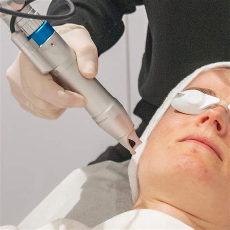 Pico Rejuvenation: Even Skin Tone in Fewer Treatments | Pico ...