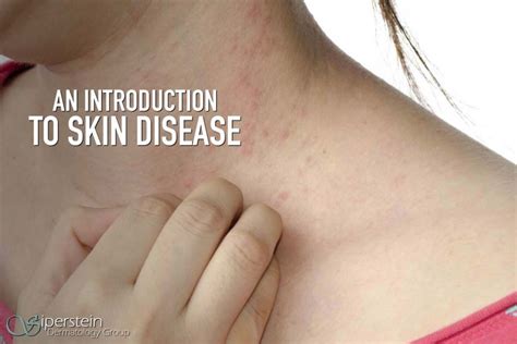 Applying Medical Skin Disease Terminology To The Common Skin Rash