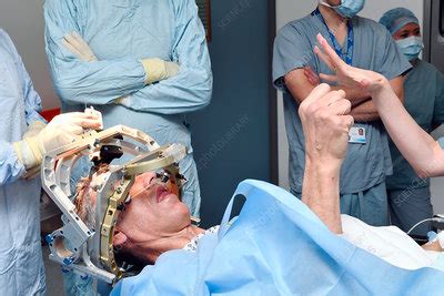 Deep brain stimulation surgery - Stock Image - C036/0671 - Science ...