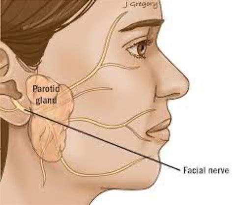 Salivary Gland Surgery - Catherine Sinclair