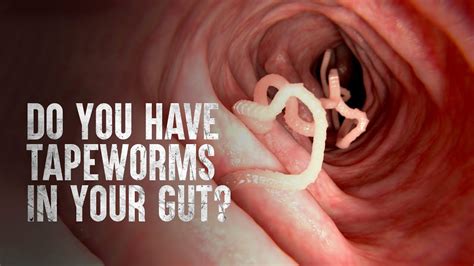 How to Survive Tapeworms (Warning: distressing footage) - YouTube