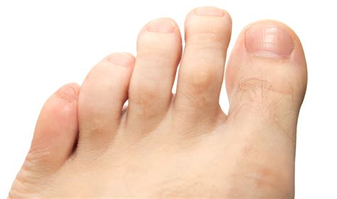 Close Up of Hairy Toes on Foot Copy | RNVPodiatry