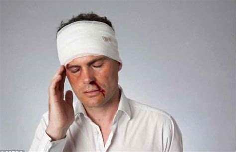 Top 3 Natural Homeopathic Remedies for Treating Head Injuries - Homeopathy at DrHomeo.com