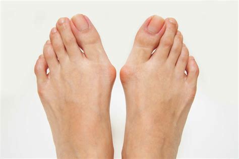 Toe Fracture Treatment | Protective Footwear | Orthotics Plus Melbourne