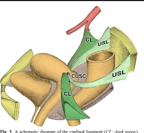 Cardinal ligament surgical anatomy: cardinal points at hysterectomy | Semantic Scholar