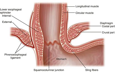 Surgical Anatomy of the Esophageal Hiatus | Abdominal Key