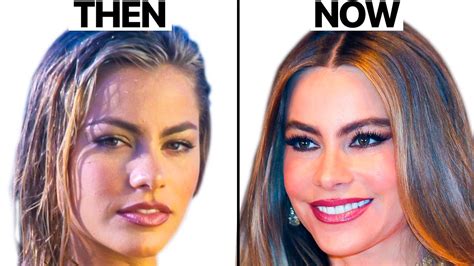 Sofia Vergara NEW Face | Plastic Surgery Analysis - Oasis Medical ...