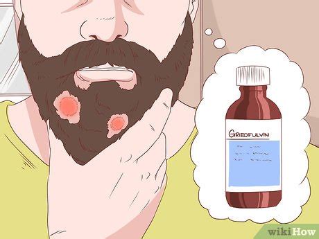 How to Prevent Skin Fungus (with Pictures) - wikiHow