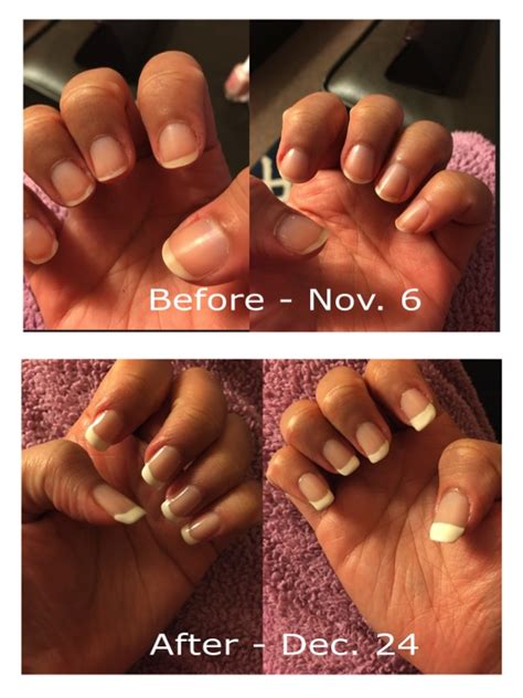 My Nail Growth Journey and the Best Tips and Tricks for Treating Your Nails