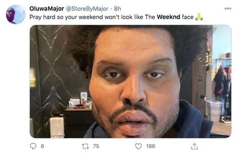 The Weeknd’s Dramatic Plastic Surgery-Enhanced Face For ‘Save Your Tears’ Music Video Leaves ...