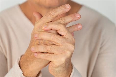 Gout In Hands: Symptoms, Causes, and Treatment - K Health