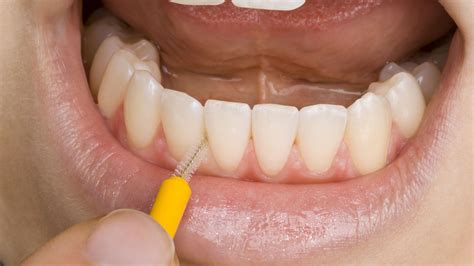 Cómo usar el cepillo interdental - Clínica Dental Dra. Mª José Barra Soto