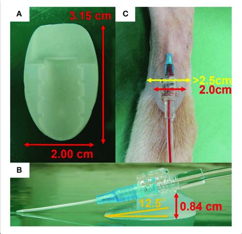 | Positioning of the arterial catheter securement device. (A) Enlarged... | Download Scientific ...