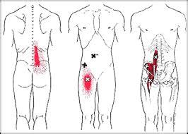 Psoas Muscle: The Hidden Cause Of Lower Back Pain - Matheson Chiropractic Clinic