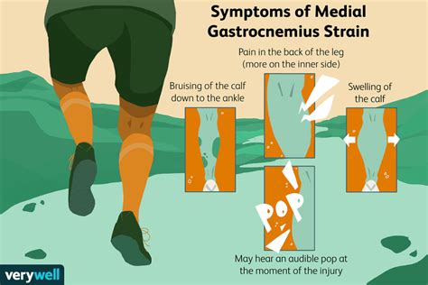 Medial Gastrocnemius Strain Overview and Treatment