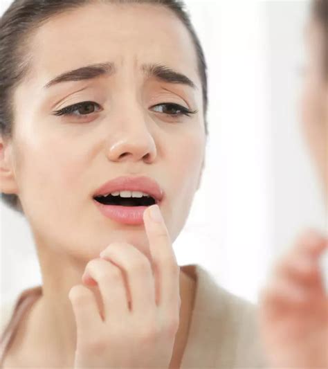 Is Hydrogen Peroxide A Cure For Cold Sores?