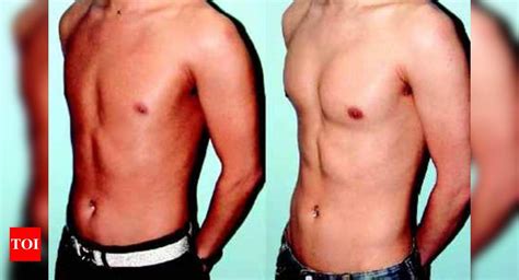 Butt, calf implants for men to look manlier - Times of India