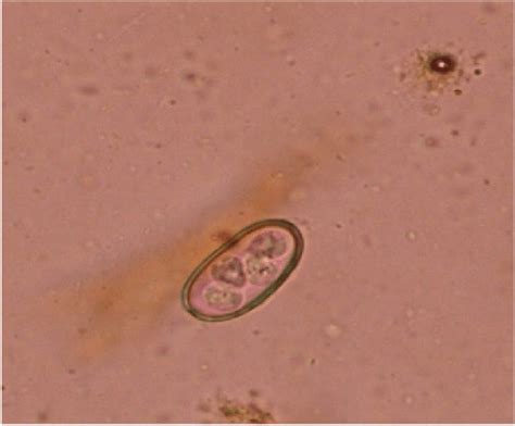 Photomicrograph of Eimeria cylindrica oocyst from blue bull. | Download ...