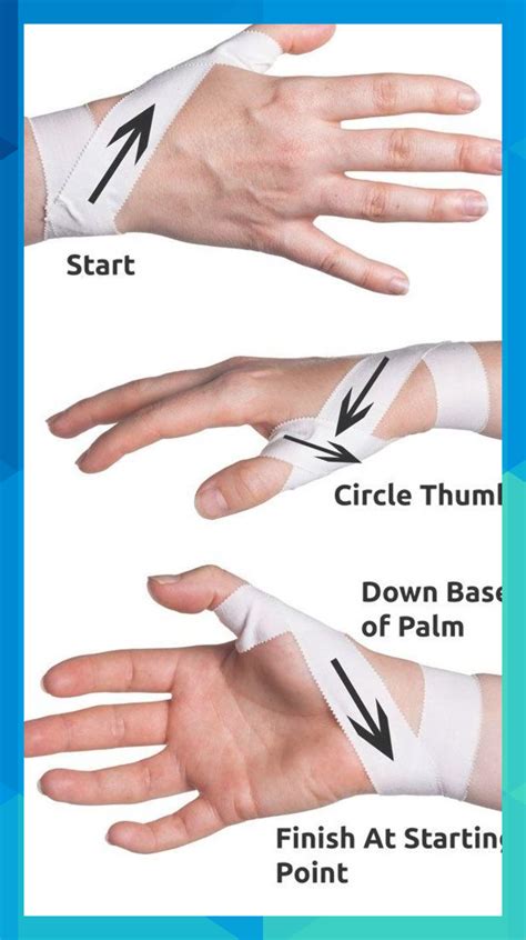 How To Treat A Sprained Thumb - unugtp