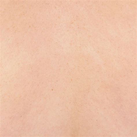 Free Real Skin Textures | Skin textures, Human skin texture, Skin