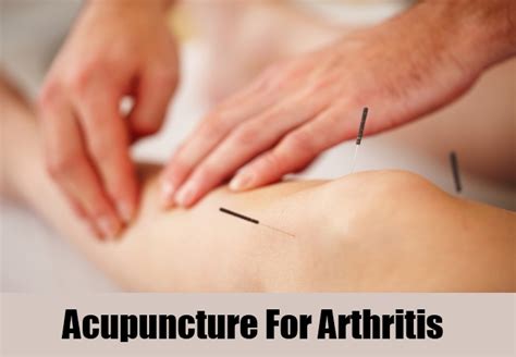 Acupuncture for Arthritis - Healing with Zen