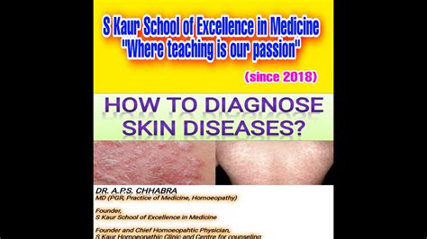 How to diagnose Skin Diseases? Must watch till end: Made diagnosis easy - YouTube